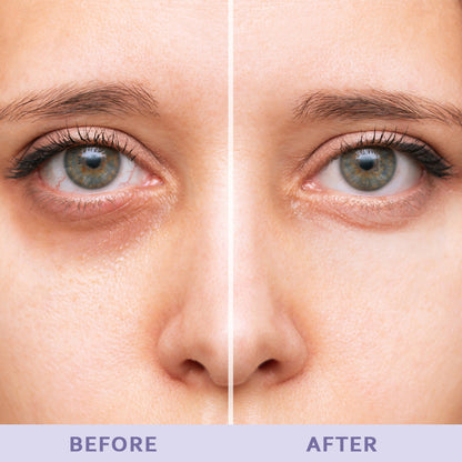 Instantly Smooth the Look of Eye Bags, Puffiness & Fine Lines